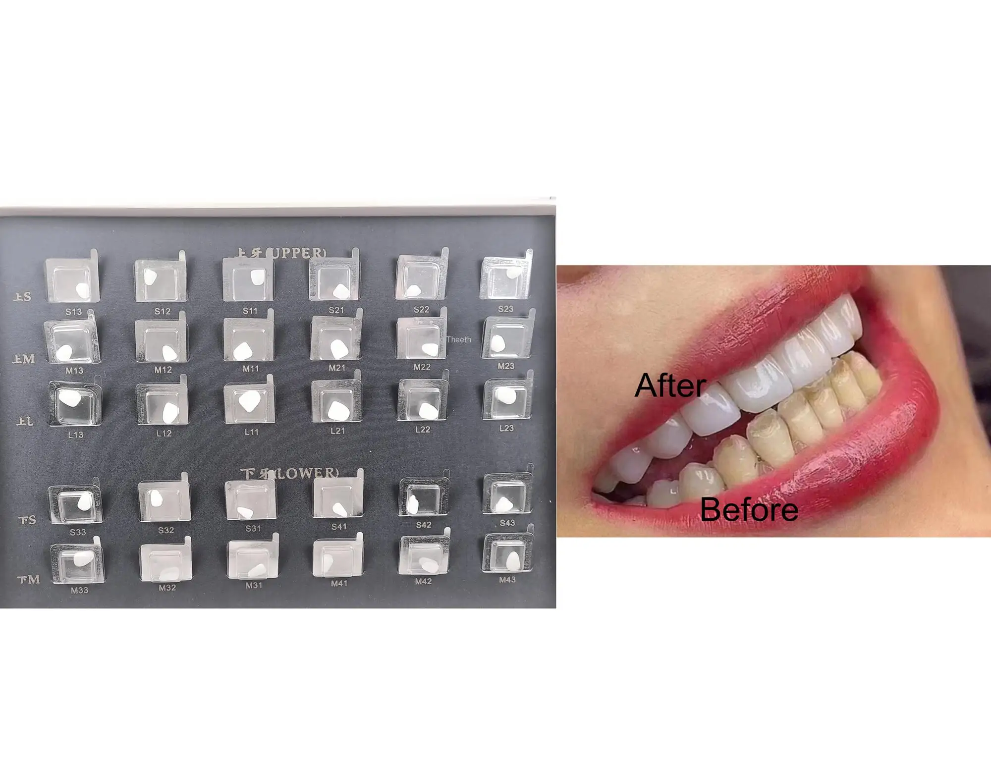

Dental Tooth Whitening Composite Porcelain Veneer Free of Mould Pre Forming 30 Tooth Patches
