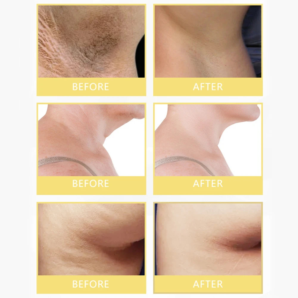 Hot sell Whitening Cream Bleaching Face Body Private Parts Whitening Cream Underarm Whitening Cream Legs Knees Body White Cream
Hot sell Whitening Cream Bleaching Face Body Private Parts Whitening Cream Underarm Whitening Cream Legs Knees Body White Cream