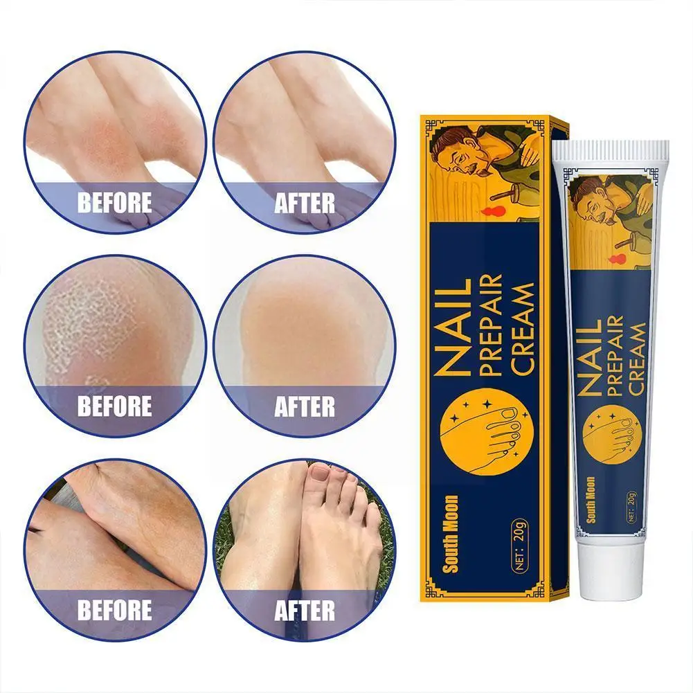 20g Athlete's Foot Repair Cream Chinese Herbal Anti Fungal Infection Repair For Itchy Feet Foot Sweat Care Foot Skin A5P8
20g Athlete's Foot Repair Cream Chinese Herbal Anti Fungal Infection Repair For Itchy Feet Foot Sweat Care Foot Skin A5P8