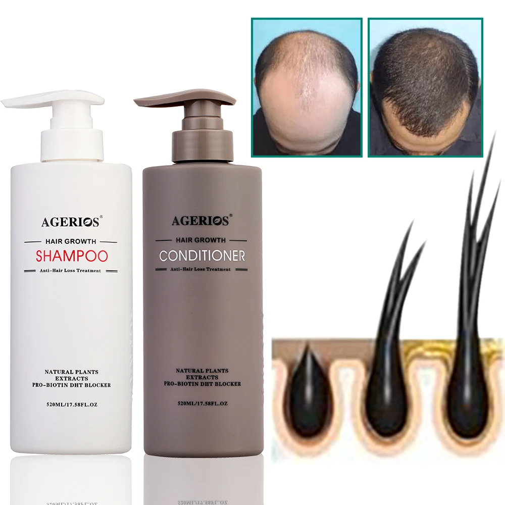 

Органический шампунь и кондиционер для роста волос AGerios, против выпадения волос, быстрое рост, более толстые волосы для мужчин и женщин, бесп...