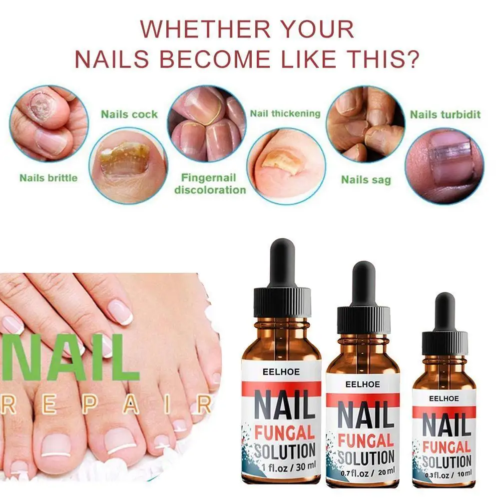 Nail Repair Serum Essences Fungal Care Treatments Foot Gel Onychomycosis Removal Anti-infective Fungus Nail Paronychia T3P4
Nail Repair Serum Essences Fungal Care Treatments Foot Gel Onychomycosis Removal Anti-infective Fungus Nail Paronychia T3P4