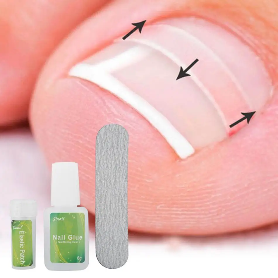 12pcs/Bottle Ingrown Toenail Correction Tool Set Ingrown Toe Nail Pedicure Elastic Patch Straightening Clip Brace with Glue
12pcs/Bottle Ingrown Toenail Correction Tool Set Ingrown Toe Nail Pedicure Elastic Patch Straightening Clip Brace with Glue