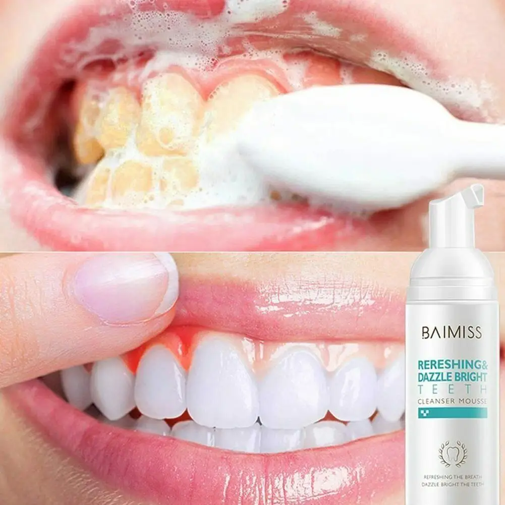 Hyun White Toothpaste Teeth Whitening Mousse Toothpaste Shining Teeth Tooth With Stains To Tooth-cleaning Bad Breath K8d8
Hyun White Toothpaste Teeth Whitening Mousse Toothpaste Shining Teeth Tooth With Stains To Tooth-cleaning Bad Breath K8d8