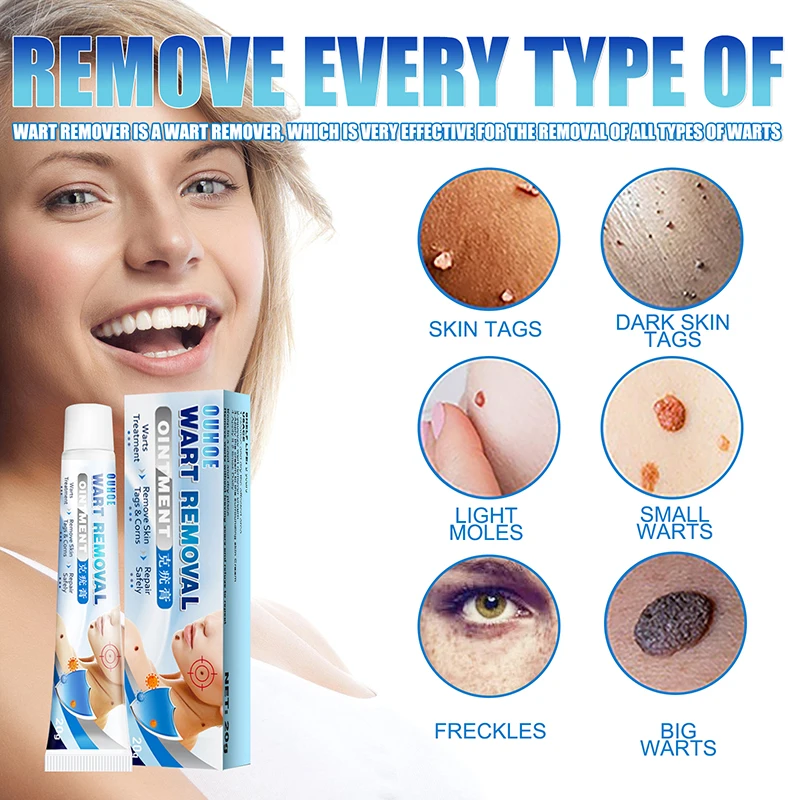 3Pcs Warts Remover Ointment Wart Cream Skin Tag Remover Extract Corn Plaster Quickly Easily Remove Common Skin Tag Scar-Free
3Pcs Warts Remover Ointment Wart Cream Skin Tag Remover Extract Corn Plaster Quickly Easily Remove Common Skin Tag Scar-Free