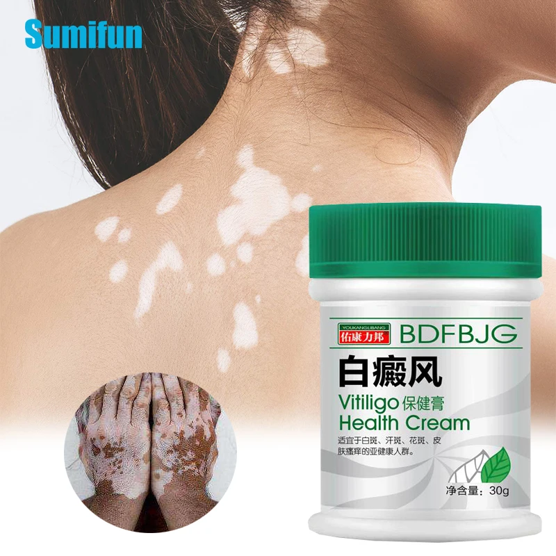 30g VitiligoTreament Cream Antibacterial Cream Psoriasis Localized Vitiligo Ointment White Spot Mycosis Leukoplakia Treat P1153
30g VitiligoTreament Cream Antibacterial Cream Psoriasis Localized Vitiligo Ointment White Spot Mycosis Leukoplakia Treat P1153
