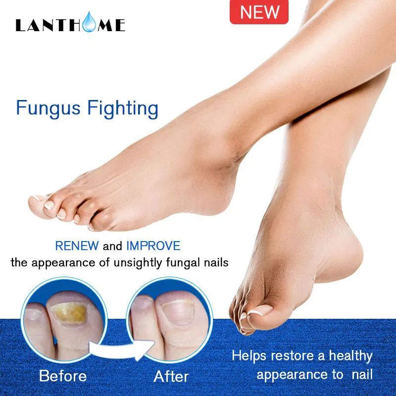 Powerful Nail Treatment Pen Onychomycosis Paronychia Anti Fungal Nail Infection Toe Fungus Chinese Herbal Care Repair Serum Tool
Powerful Nail Treatment Pen Onychomycosis Paronychia Anti Fungal Nail Infection Toe Fungus Chinese Herbal Care Repair Serum Tool