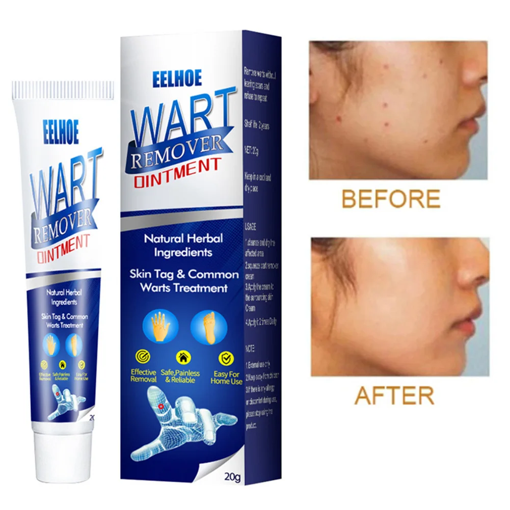 Skin Tags Remover Cream Safe And Gentle Warts Mole Skin Tags Treatment Cream For Men Women Warts Removal
Skin Tags Remover Cream Safe And Gentle Warts Mole Skin Tags Treatment Cream For Men Women Warts Removal