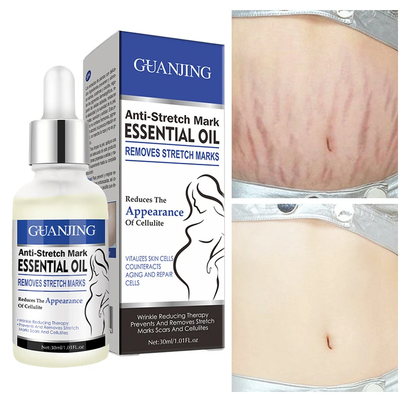 Stretch Marks Removal Essential Oils Body Care Stretch Marks Remover Obesity Postpartum Anti-wrinkle Repair Cream Skin Care
Stretch Marks Removal Essential Oils Body Care Stretch Marks Remover Obesity Postpartum Anti-wrinkle Repair Cream Skin Care