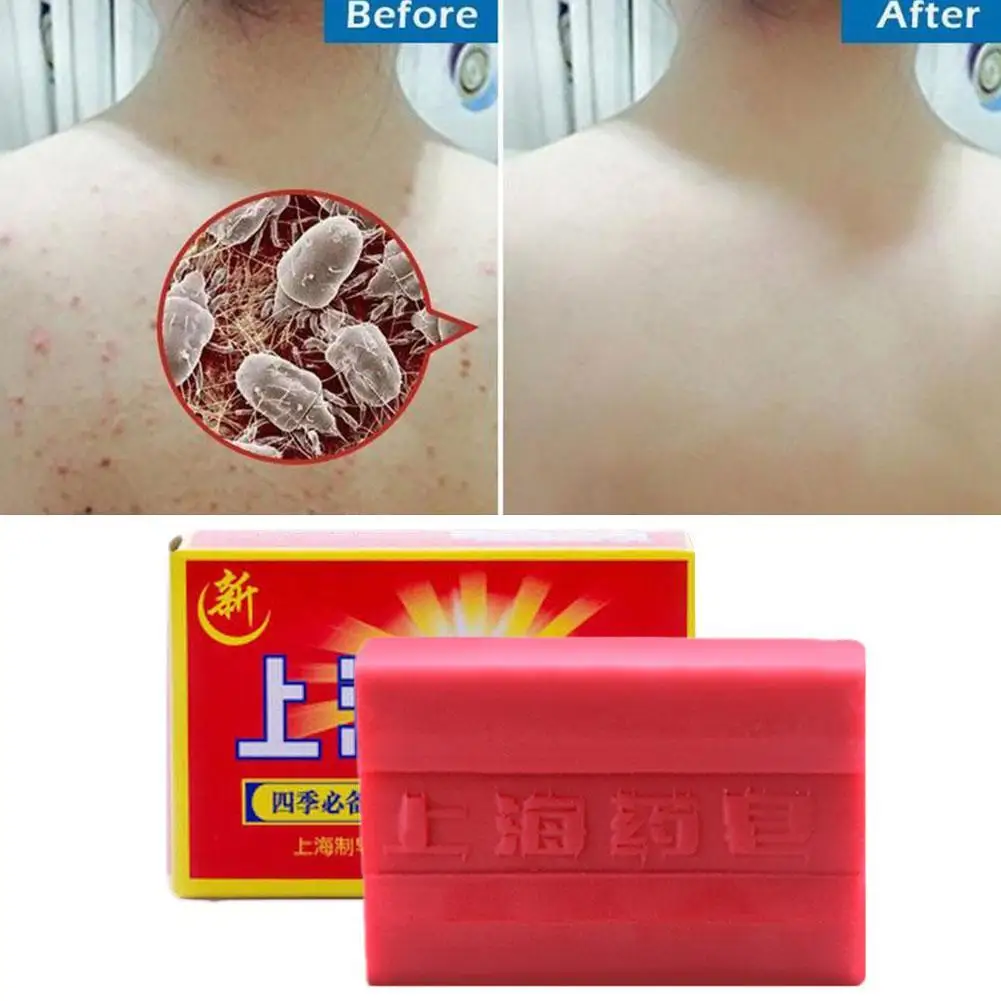 90g Red China Medicated Soap Conditions Acne Psoriasis Seborrhea Eczema Anti Fungus Bath Healthy Soap Slimming Body Cream
90g Red China Medicated Soap Conditions Acne Psoriasis Seborrhea Eczema Anti Fungus Bath Healthy Soap Slimming Body Cream