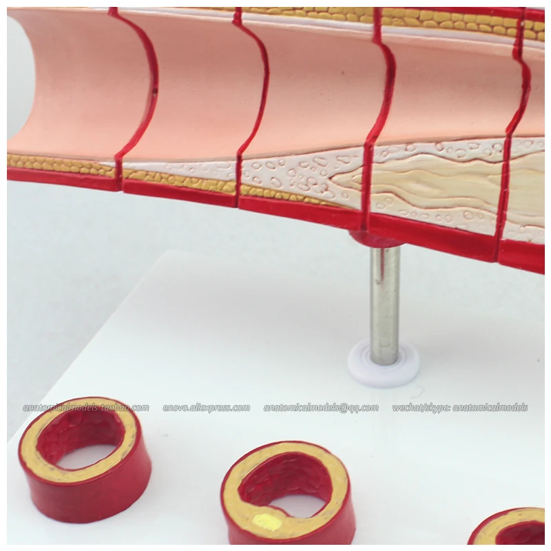 CMAM/12484 Heart-Vascular cholesterol, Human Heart Medical Teaching Anatomical Model
CMAM/12484 Heart-Vascular cholesterol, Human Heart Medical Teaching Anatomical Model