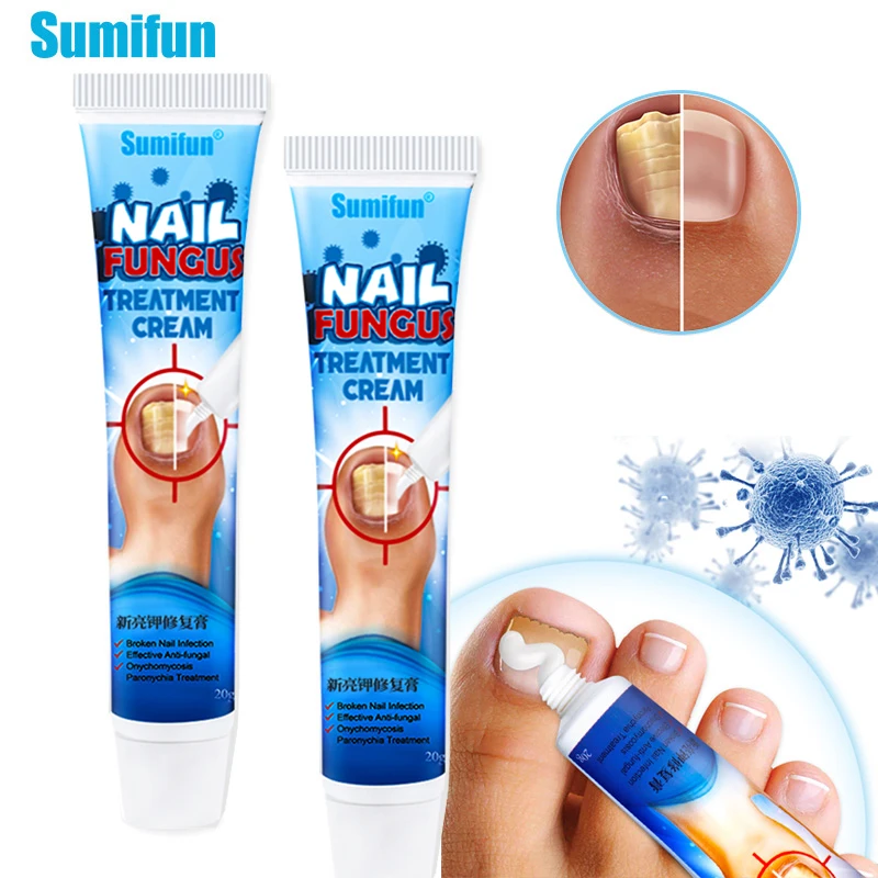 1Pcs Nail Fungus Removal Cream Onychomycosis Fungal Nail Treatment Paronychia Anti Infection Feet Toe Fungal Nail Care Ointment
1Pcs Nail Fungus Removal Cream Onychomycosis Fungal Nail Treatment Paronychia Anti Infection Feet Toe Fungal Nail Care Ointment