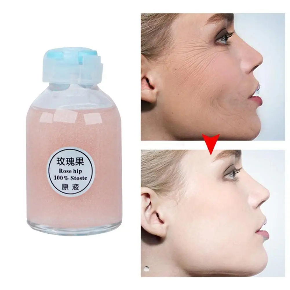 30ml Rosehip Essence Brighten Skin Tone And Rejuvenate Pores Essence Brightening And Whitening Essence
30ml Rosehip Essence Brighten Skin Tone And Rejuvenate Pores Essence Brightening And Whitening Essence