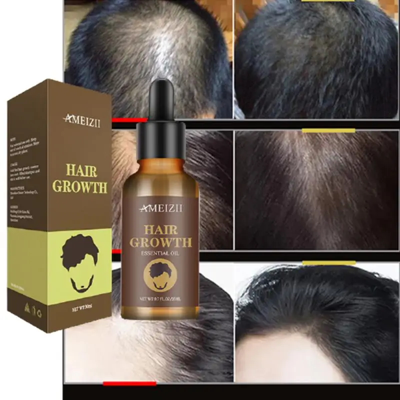 Hair Growth Products Fast Growing Hair Oil Hair Loss Care Spray Beauty Hair & Scalp Treatment For Thick Hair Growth Serum 30ml
Hair Growth Products Fast Growing Hair Oil Hair Loss Care Spray Beauty Hair & Scalp Treatment For Thick Hair Growth Serum 30ml