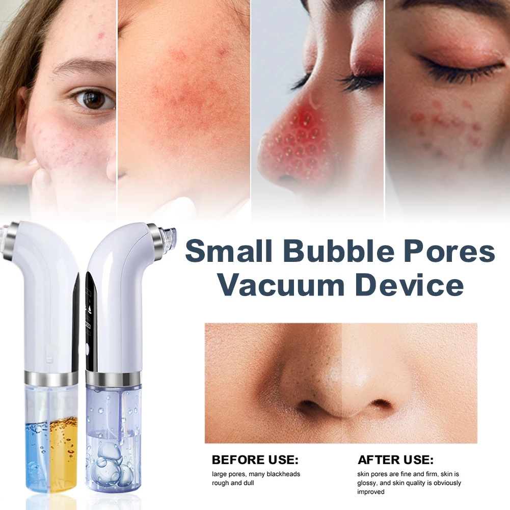 NewBlackhead Remover Face Deep Nose Cleaner T Zone Pore Acne Pimple Removal Vacuum Suction Facial Diamond Beauty Clean Skin Tool
NewBlackhead Remover Face Deep Nose Cleaner T Zone Pore Acne Pimple Removal Vacuum Suction Facial Diamond Beauty Clean Skin Tool