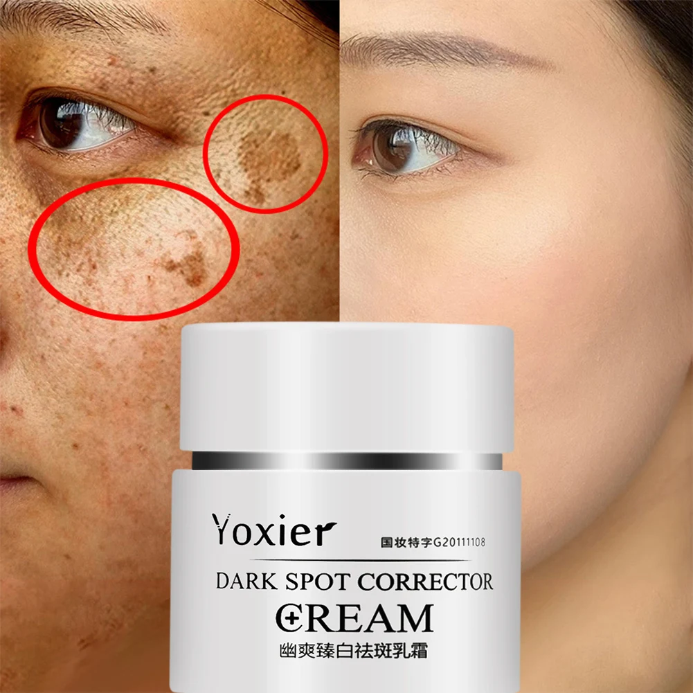 30g Face Cream Dark Spot Corrector Anti-Aging Whitening Moisturizing Remove Sunburn Dark Spots and Acne Pigmentation Face Cream
30g Face Cream Dark Spot Corrector Anti-Aging Whitening Moisturizing Remove Sunburn Dark Spots and Acne Pigmentation Face Cream