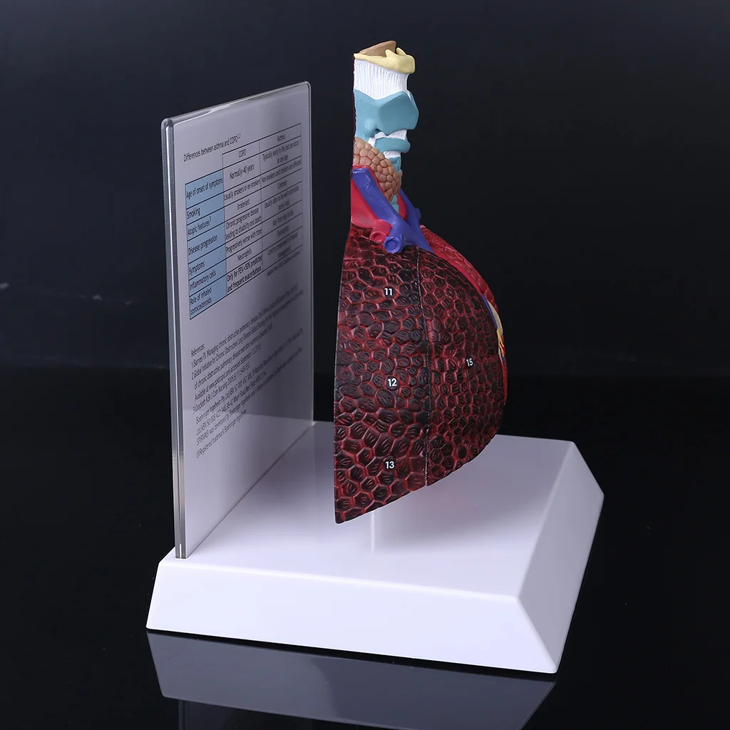 Life Size Human Lung Model Anatomical Respiratory System Anatomy for School Science Resources Study Display Teaching Tool
Life Size Human Lung Model Anatomical Respiratory System Anatomy for School Science Resources Study Display Teaching Tool