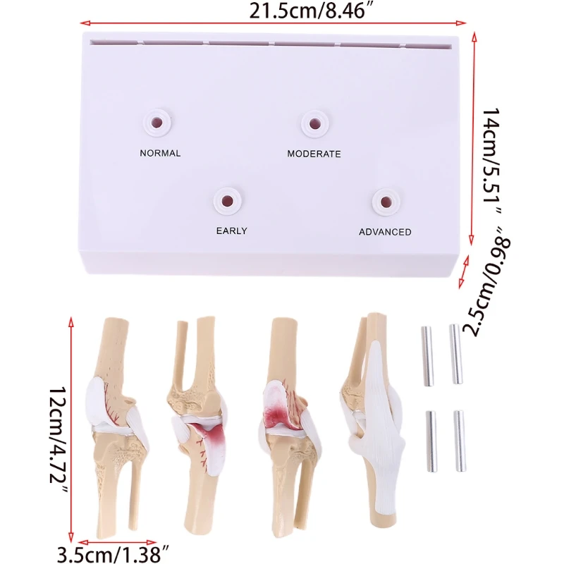 2021 New Animal Dog Canine Knee Joint Model Skeleton Veterinary Teaching Research Display
2021 New Animal Dog Canine Knee Joint Model Skeleton Veterinary Teaching Research Display