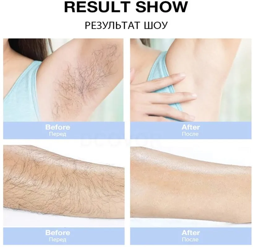 IPL Hair Removal Laser Epilator 900000 Flashes Painless Permanent Depilador Bikini Face Body Electric Photoepilator for Women
IPL Hair Removal Laser Epilator 900000 Flashes Painless Permanent Depilador Bikini Face Body Electric Photoepilator for Women