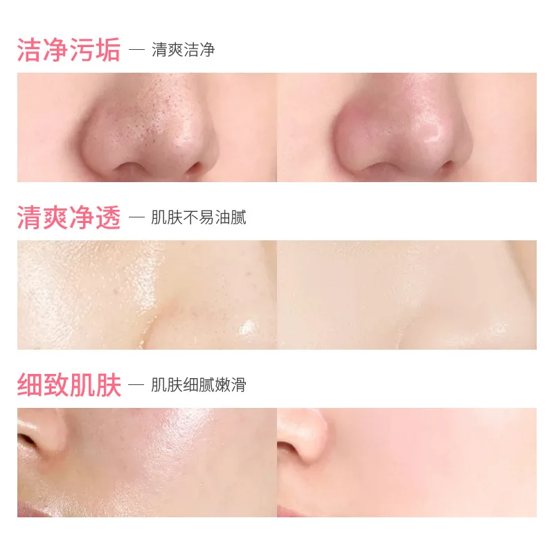 Whitening Skin Care Products 
Whitening Skin Care Products