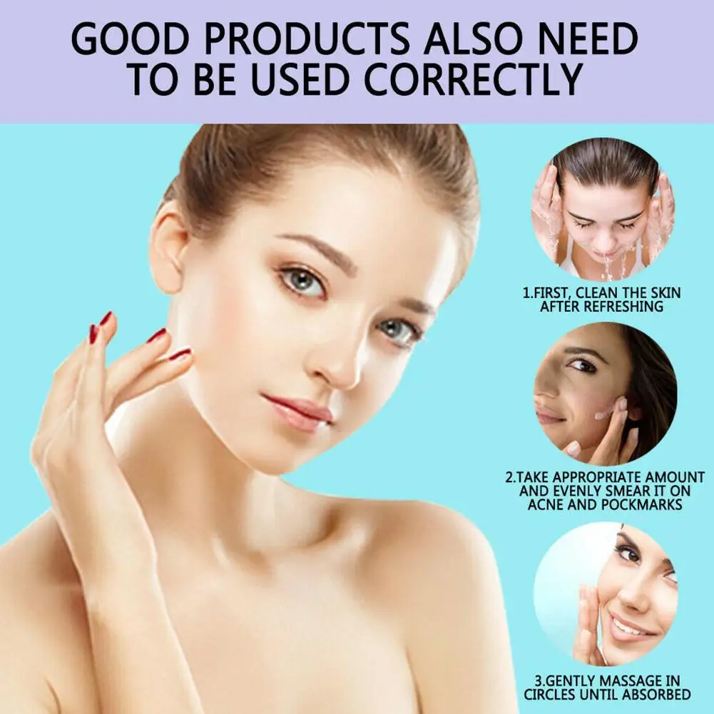 30g Blemish Cream Pure Skin Anti Acne Scar Cream Freckles Acne Pimple Scar Dark Spots Removal Skin Whitening
30g Blemish Cream Pure Skin Anti Acne Scar Cream Freckles Acne Pimple Scar Dark Spots Removal Skin Whitening
