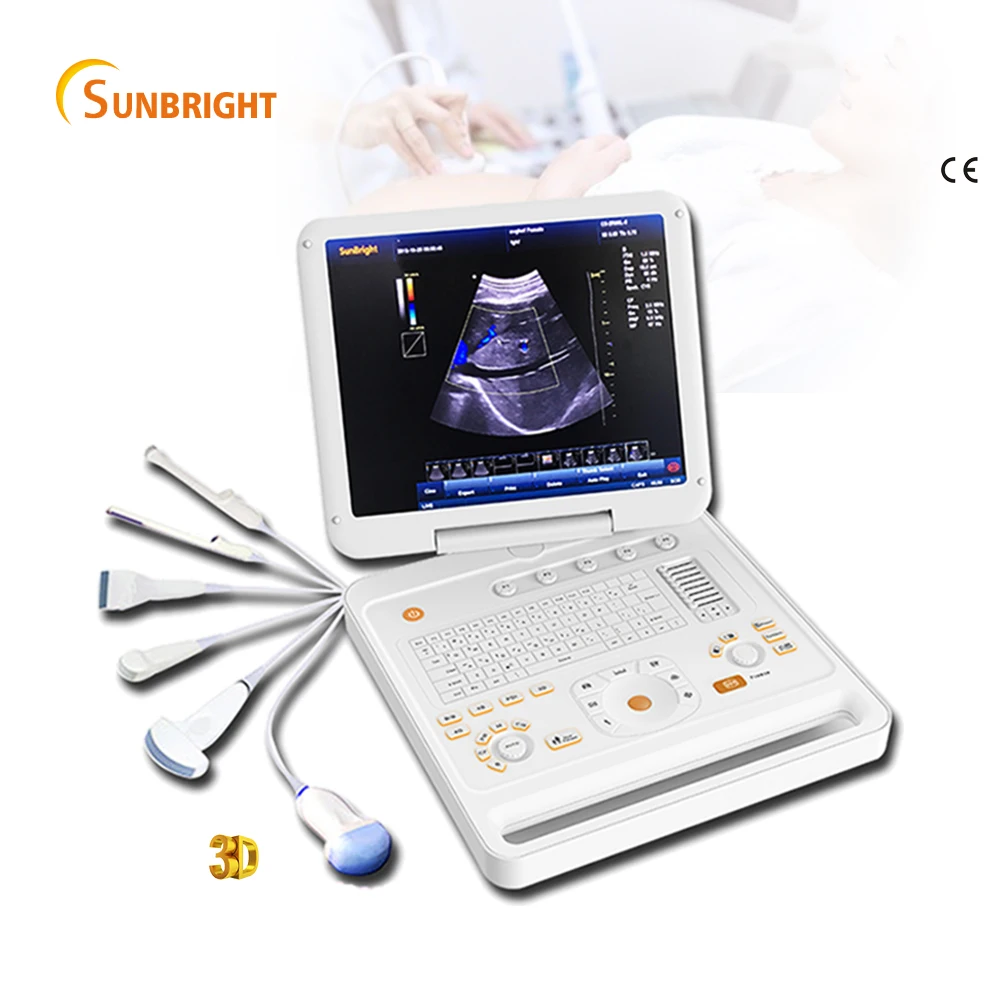 Echograph medical ultrasound 3D portable color doppler machine SUN-906A
Echograph medical ultrasound 3D portable color doppler machine SUN-906A