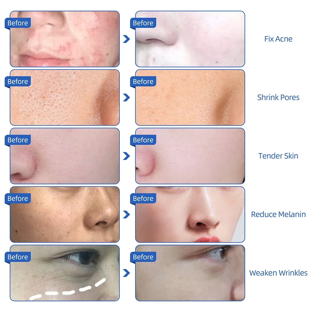 Korean 7 colors LED Facial Mask face mask Skin Care beauty Mask Photon Therapy Light Skin Rejuvenation Facial PDT Instrument
Korean 7 colors LED Facial Mask face mask Skin Care beauty Mask Photon Therapy Light Skin Rejuvenation Facial PDT Instrument