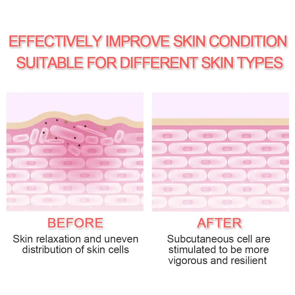 5in1 RF&EMS Radio Mesotherapy Electroporation Face Beauty Pen Radio Frequency LED Photon Face Skin Rejuvenation Remover Wrinkle
5in1 RF&EMS Radio Mesotherapy Electroporation Face Beauty Pen Radio Frequency LED Photon Face Skin Rejuvenation Remover Wrinkle