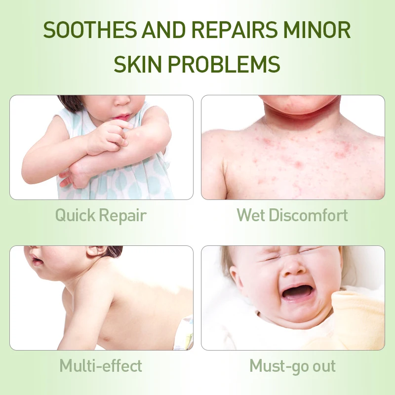 New Arrival White Cool Oil Peppermint Cream To Prevent Mosquito Bites Headache Muscle Aches Pain Relieving Ointment 50g
New Arrival White Cool Oil Peppermint Cream To Prevent Mosquito Bites Headache Muscle Aches Pain Relieving Ointment 50g