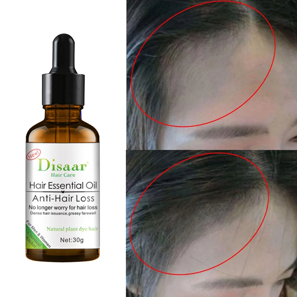30ml Hair Repair Treatment Serum Hair Essential Oil Anti Hair Loss Repair Damaged Hair Massage Oil for Smooth Glossy Hair Serum
30ml Hair Repair Treatment Serum Hair Essential Oil Anti Hair Loss Repair Damaged Hair Massage Oil for Smooth Glossy Hair Serum
