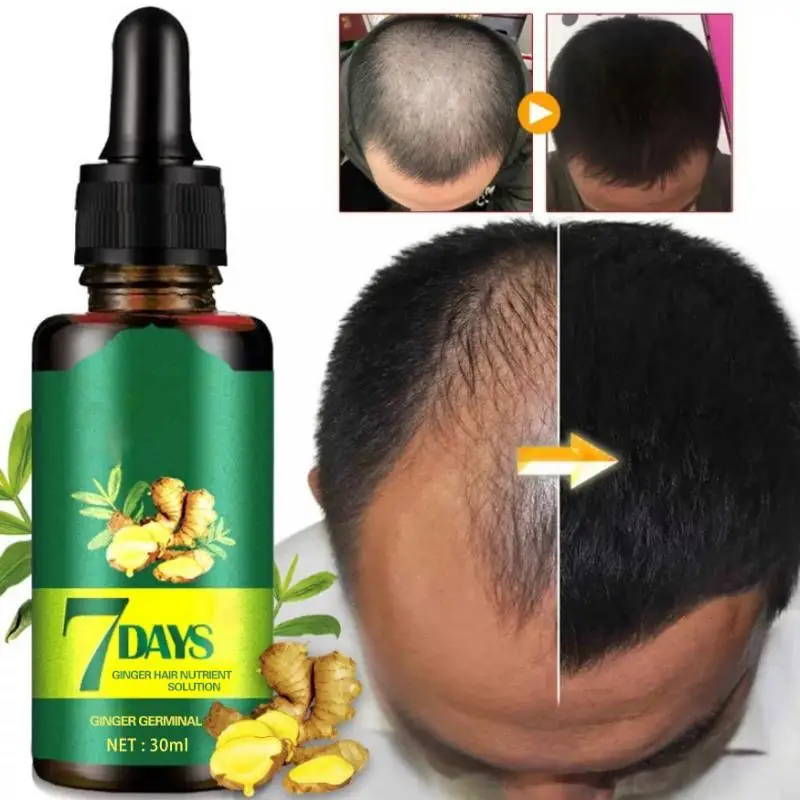 30ML Hair Care Growth Products Oil for Hair Beard Faster Regrowth Hair Loss Treatment Serum Edge Control Makeup Beauty Tools
30ML Hair Care Growth Products Oil for Hair Beard Faster Regrowth Hair Loss Treatment Serum Edge Control Makeup Beauty Tools