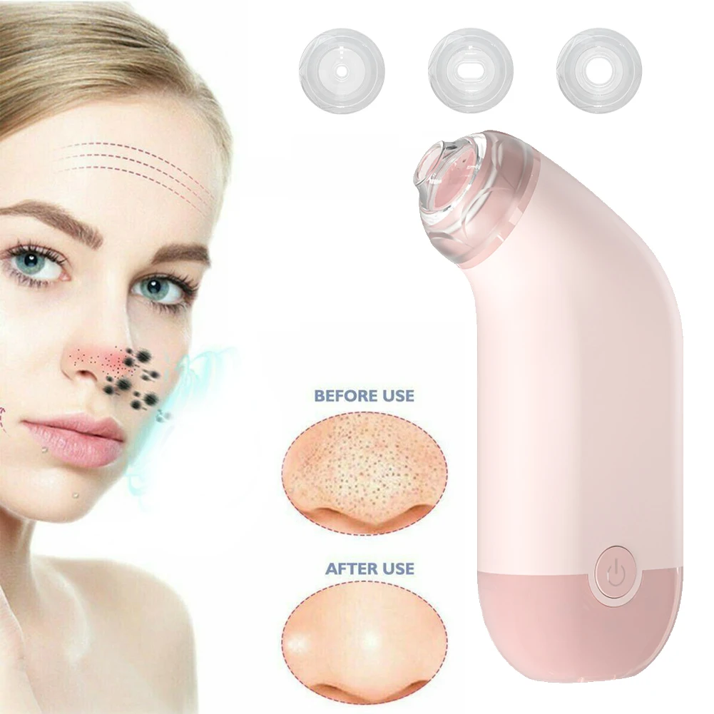 Blackhead Remover Vacuum Pore Cleaner tools Electric Nose Face Deep Cleansing Skin Care Dropshipping Beauty Clean Skin Tool
Blackhead Remover Vacuum Pore Cleaner tools Electric Nose Face Deep Cleansing Skin Care Dropshipping Beauty Clean Skin Tool