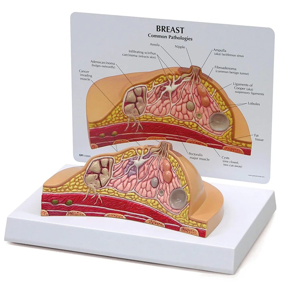 Female Breast Structure Anatomical Model Disease Cancer Pathological Breast Anatomy Model Medical Education and Training
Female Breast Structure Anatomical Model Disease Cancer Pathological Breast Anatomy Model Medical Education and Training