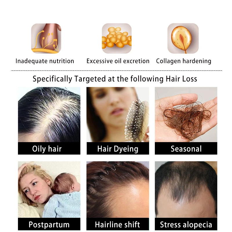 Organic Natural Ginger Hair Growth Shampo Anti Hair Loss Treatment Hair Shampoo for Women and Men Repair Hair Care,hair grown 
Organic Natural Ginger Hair Growth Shampo Anti Hair Loss Treatment Hair Shampoo for Women and Men Repair Hair Care,hair grown