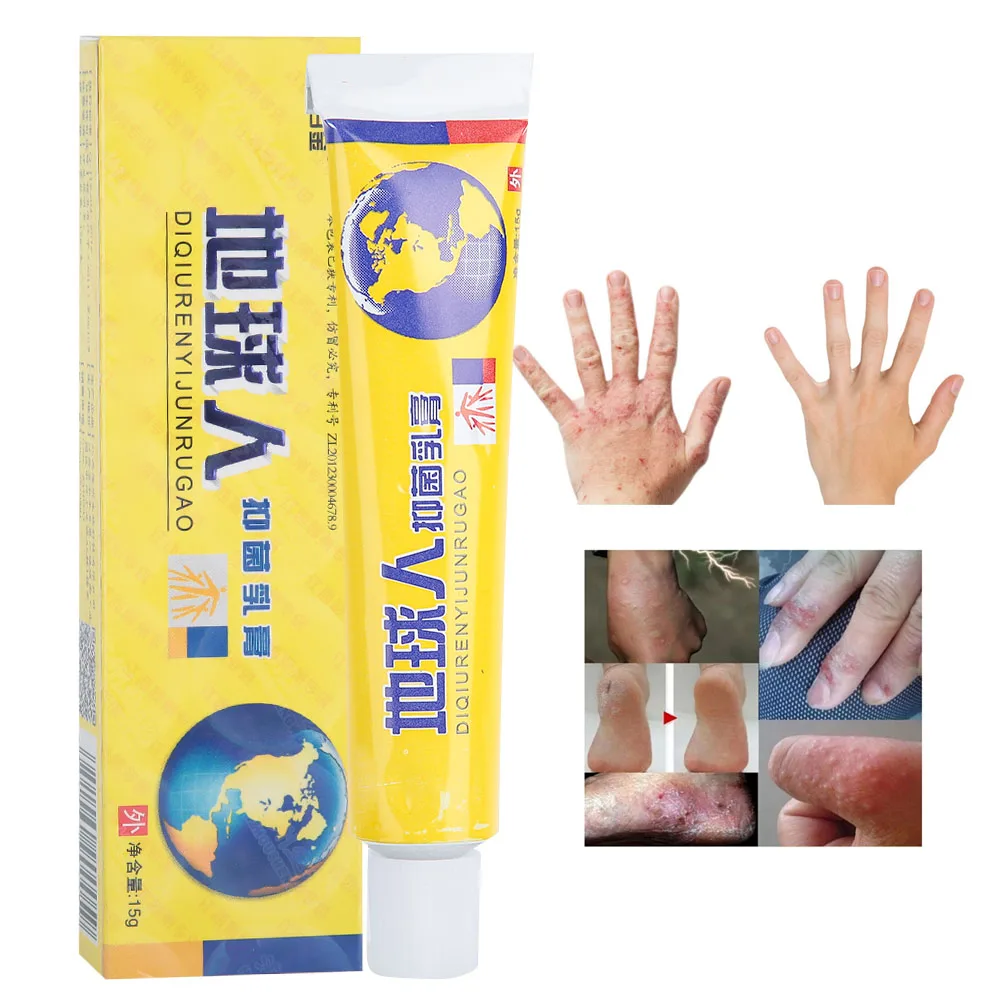 15g Skin Care Cream Psoriasis Dermatitis Tinea Pedis Anti-Itching Eczema Antibacterial Body Cream Mild Ingredietns Repair Skin
15g Skin Care Cream Psoriasis Dermatitis Tinea Pedis Anti-Itching Eczema Antibacterial Body Cream Mild Ingredietns Repair Skin
