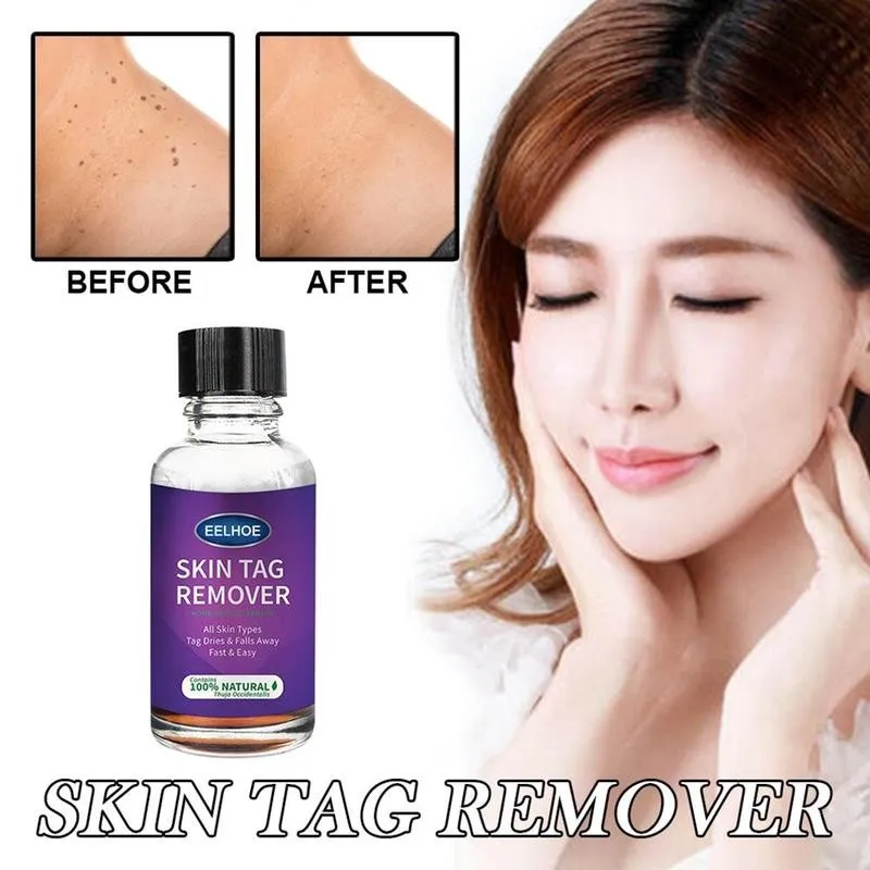 Remover Warts Removal Relief Medical Treatment Meat Corn Skin Flat Wart Antibacterial Liquid Foot Calluses Skin Care Cream
Remover Warts Removal Relief Medical Treatment Meat Corn Skin Flat Wart Antibacterial Liquid Foot Calluses Skin Care Cream
