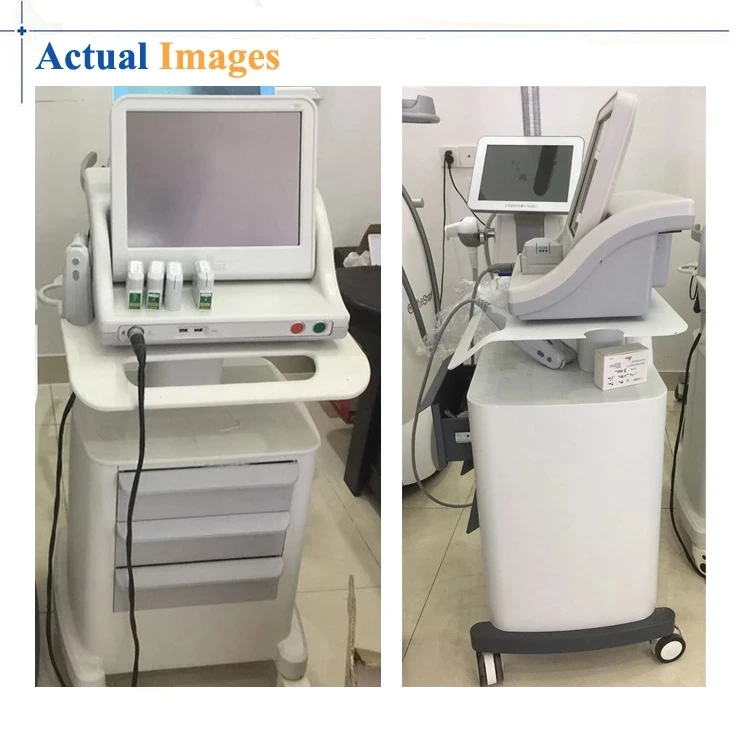 Anti-wrinkle skin tightening machine beauty face tool body shaping sliming face and body massager
Anti-wrinkle skin tightening machine beauty face tool body shaping sliming face and body massager