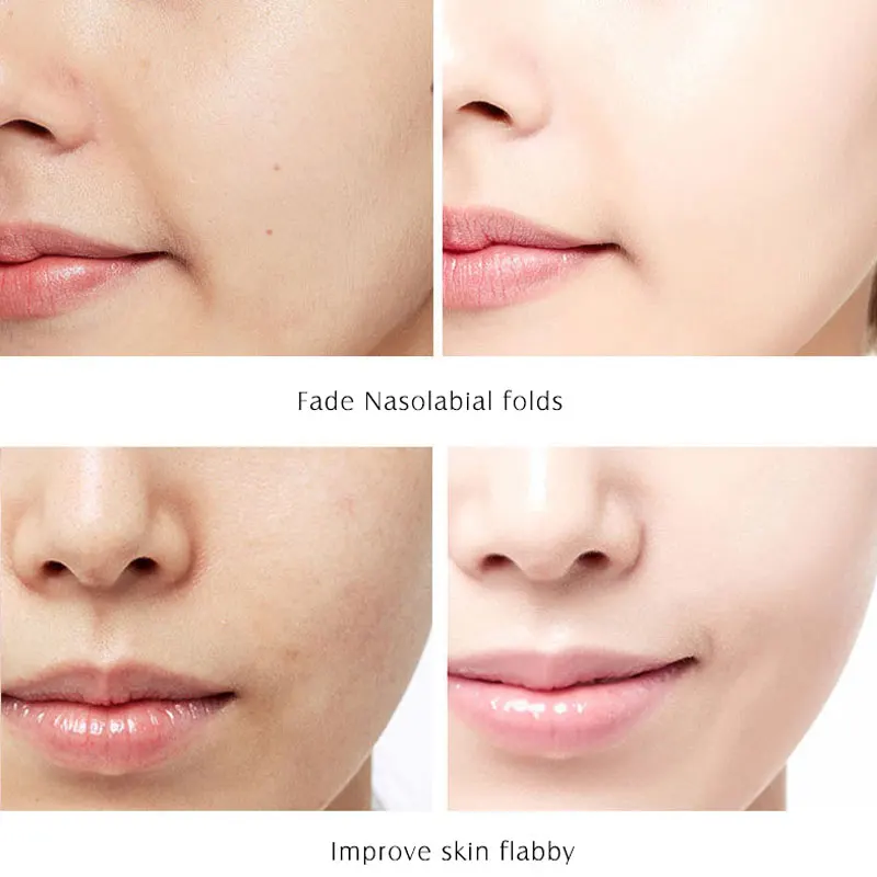 ARTISCARE Platinum Six Peptides Serum for Face 20ml Anti Wrinkles Ageing Hyaluronic Acid Essence Whitening Facial Skin Care 3PCS
ARTISCARE Platinum Six Peptides Serum for Face 20ml Anti Wrinkles Ageing Hyaluronic Acid Essence Whitening Facial Skin Care 3PCS