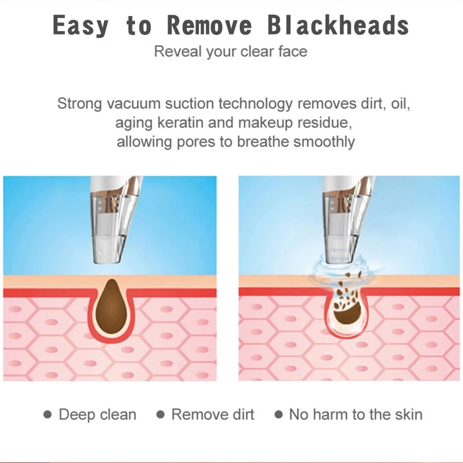 Electric Blackhead Remover Needles Acne Black Spot Extractor Vacuum Suction Deep Cleansing Machine Exfoliating Pore Cleaner
Electric Blackhead Remover Needles Acne Black Spot Extractor Vacuum Suction Deep Cleansing Machine Exfoliating Pore Cleaner