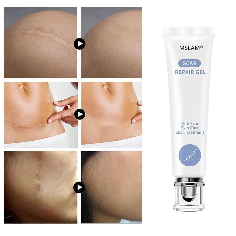 Scar Repair Gel Removal Scar Acne Cream Treatment Marks Skin Corrector Pigmentation Body For Face I0V4
Scar Repair Gel Removal Scar Acne Cream Treatment Marks Skin Corrector Pigmentation Body For Face I0V4