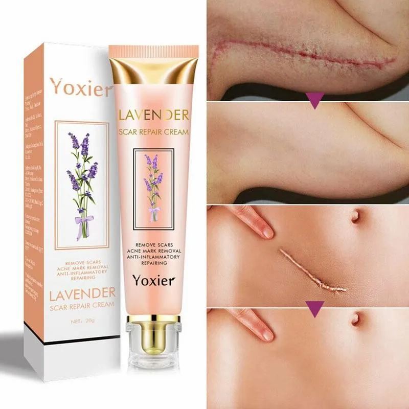 1pcs Repair Scar Cream Pigmentation Corrector Anti-allergic Calm Whitening Face Cream Acne Scar Stretch Marks Skin Care
1pcs Repair Scar Cream Pigmentation Corrector Anti-allergic Calm Whitening Face Cream Acne Scar Stretch Marks Skin Care