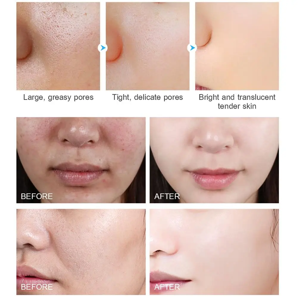 30ml Face Serum Hyaluronic Acid Moisturizing Facial Essence Tightens Shrink Pores Nourishes Face Smoothes Fine Lines Skin Care
30ml Face Serum Hyaluronic Acid Moisturizing Facial Essence Tightens Shrink Pores Nourishes Face Smoothes Fine Lines Skin Care