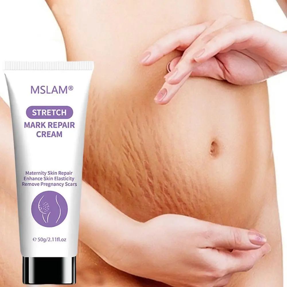 Stretch Mark Repair Cream Pregnancy Scars Ance Maternity Growth Firming Anti Body 50ml Reduce Aging Line Fat Cream Lines Ca S1H5
Stretch Mark Repair Cream Pregnancy Scars Ance Maternity Growth Firming Anti Body 50ml Reduce Aging Line Fat Cream Lines Ca S1H5