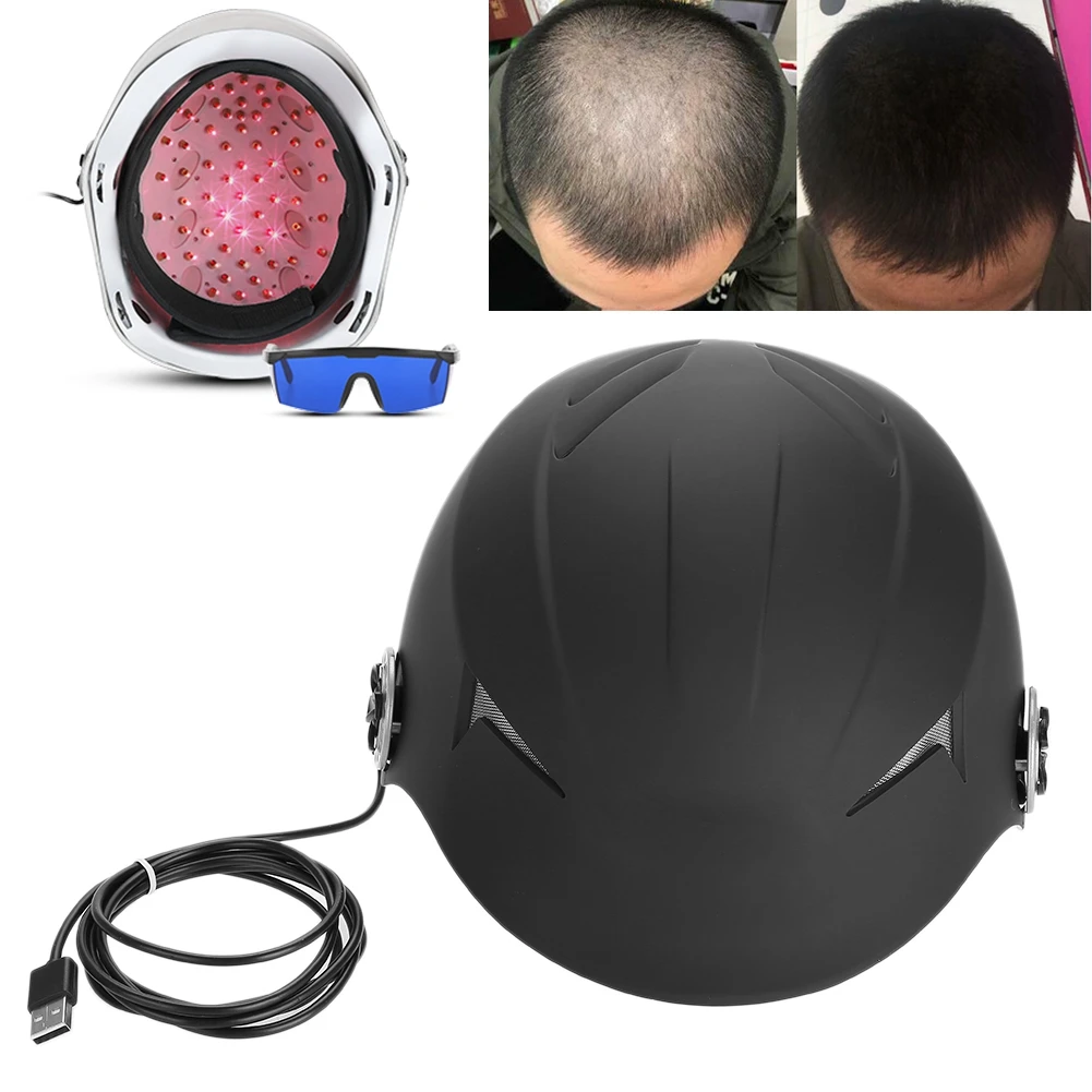 68 Diodes Hair Regrow Laser Helmet Hair Fast Growth Treatment Cap Preventing Hair Loss Helmet Hair Care Products For Men Women
68 Diodes Hair Regrow Laser Helmet Hair Fast Growth Treatment Cap Preventing Hair Loss Helmet Hair Care Products For Men Women