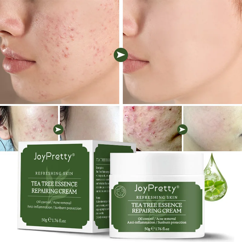 Acne Removal Tea Tree Essence Repairing Facial Cream Anti-inflammation Exfoliating Moisturizing Oil Control Cosmetics Face Care
Acne Removal Tea Tree Essence Repairing Facial Cream Anti-inflammation Exfoliating Moisturizing Oil Control Cosmetics Face Care