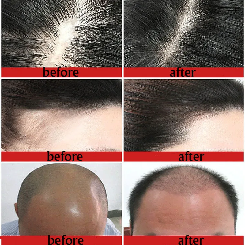 2020 New Hair Growth Essence Fast Powerful Hair Growth Essential Oil Hair Loss Treatment Help For hair Growth Hair Care
2020 New Hair Growth Essence Fast Powerful Hair Growth Essential Oil Hair Loss Treatment Help For hair Growth Hair Care