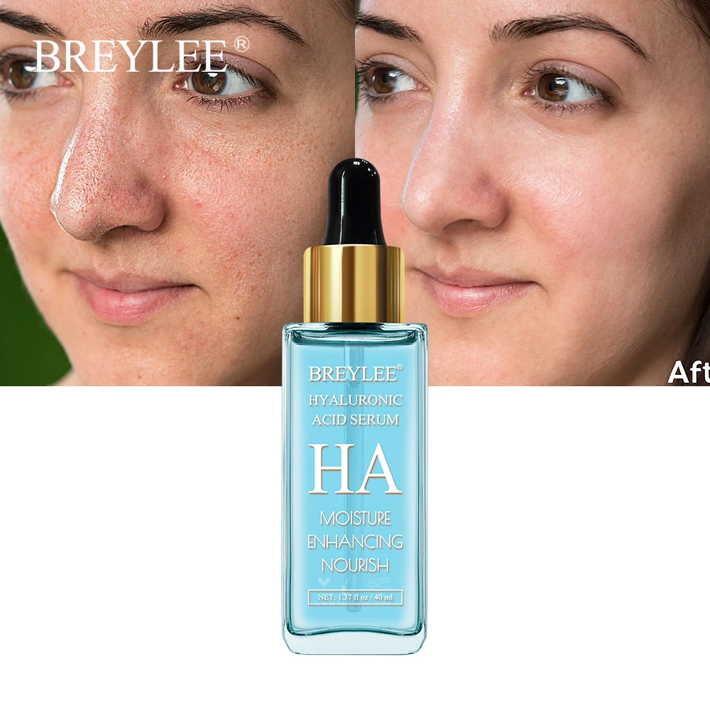Hyaluronic Acid Serum Hydrating Dry Skin Care Moisturizing Anti Aging Elasticity Absorbed Easily Facial Essence 40ml
Hyaluronic Acid Serum Hydrating Dry Skin Care Moisturizing Anti Aging Elasticity Absorbed Easily Facial Essence 40ml
