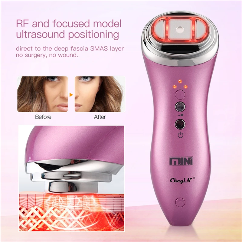 HIFU Ultrasound Vibration Face Skin Tightening Machine RF Lifting Anti-aging Facial Toning Rejuvenation Wrinkles Removing Tool
HIFU Ultrasound Vibration Face Skin Tightening Machine RF Lifting Anti-aging Facial Toning Rejuvenation Wrinkles Removing Tool