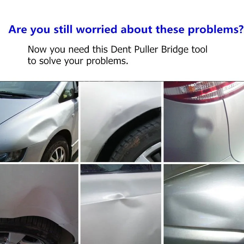 Down Dent Removal Black Tools Repair Upgraded Paintless Durable Auto Super Bridge Pulling High Quality
Down Dent Removal Black Tools Repair Upgraded Paintless Durable Auto Super Bridge Pulling High Quality