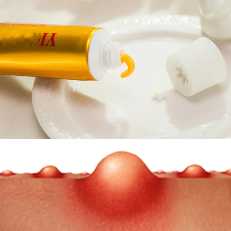 Psoriasis Cream Dermatitis Eczema Antibacterial Chinese Herbal Massage Ointment Treatment 15gAntipruritic Nourish Body Skin Care
Psoriasis Cream Dermatitis Eczema Antibacterial Chinese Herbal Massage Ointment Treatment 15gAntipruritic Nourish Body Skin Care