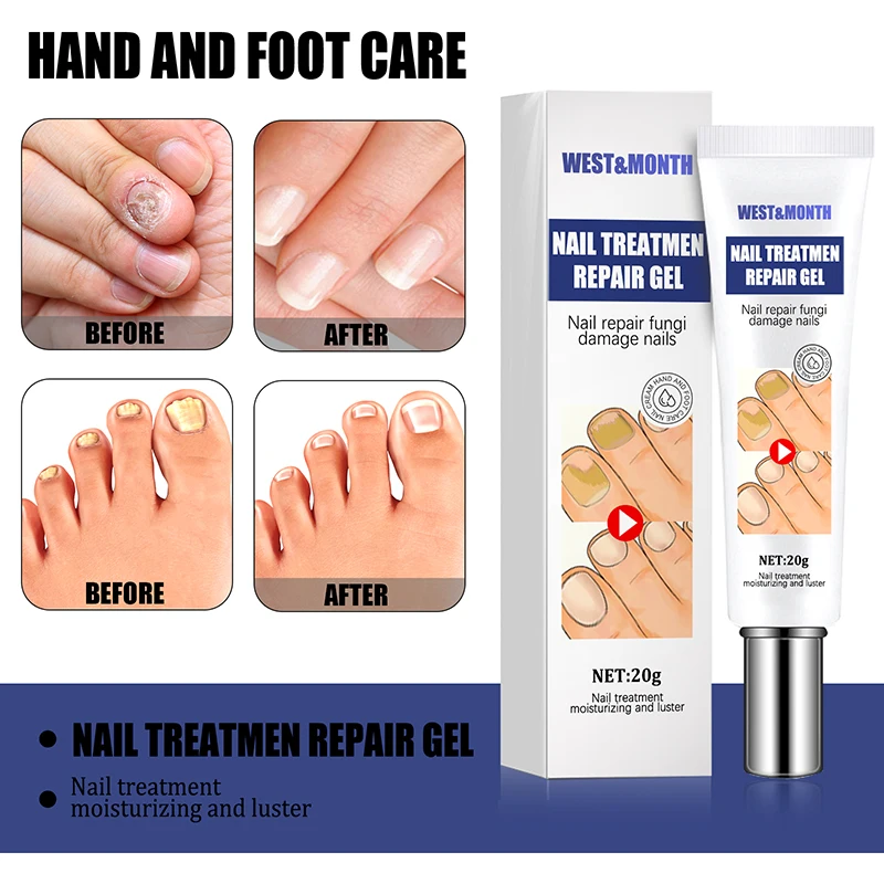 Multipurpose Nails Treatment Repair Gel Portable Professional Hand And Foot Care Cream for Women Men NIN668
Multipurpose Nails Treatment Repair Gel Portable Professional Hand And Foot Care Cream for Women Men NIN668